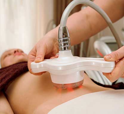 RF-лифтинг тела на аппарате 3-MAX в Екатеринбурге