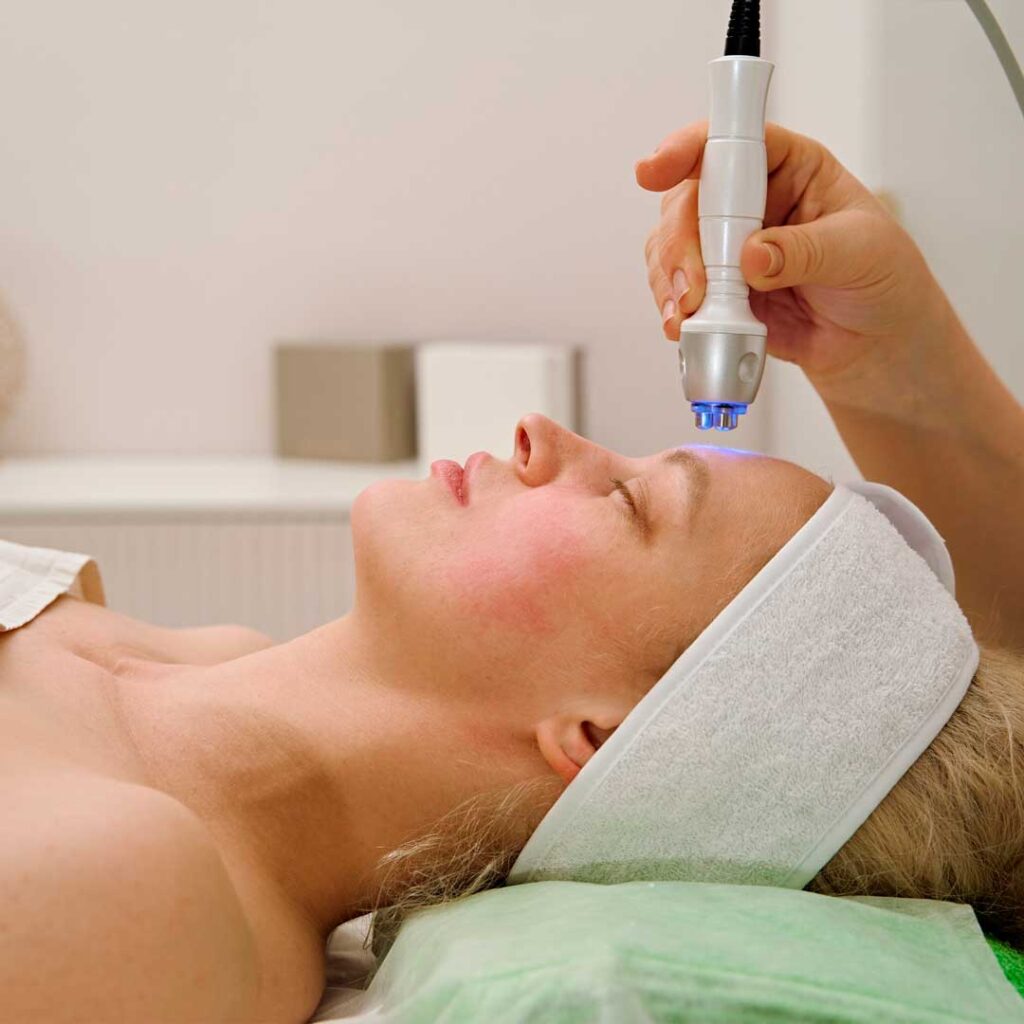 RF-лифтинг лица на аппарате 3-MAX