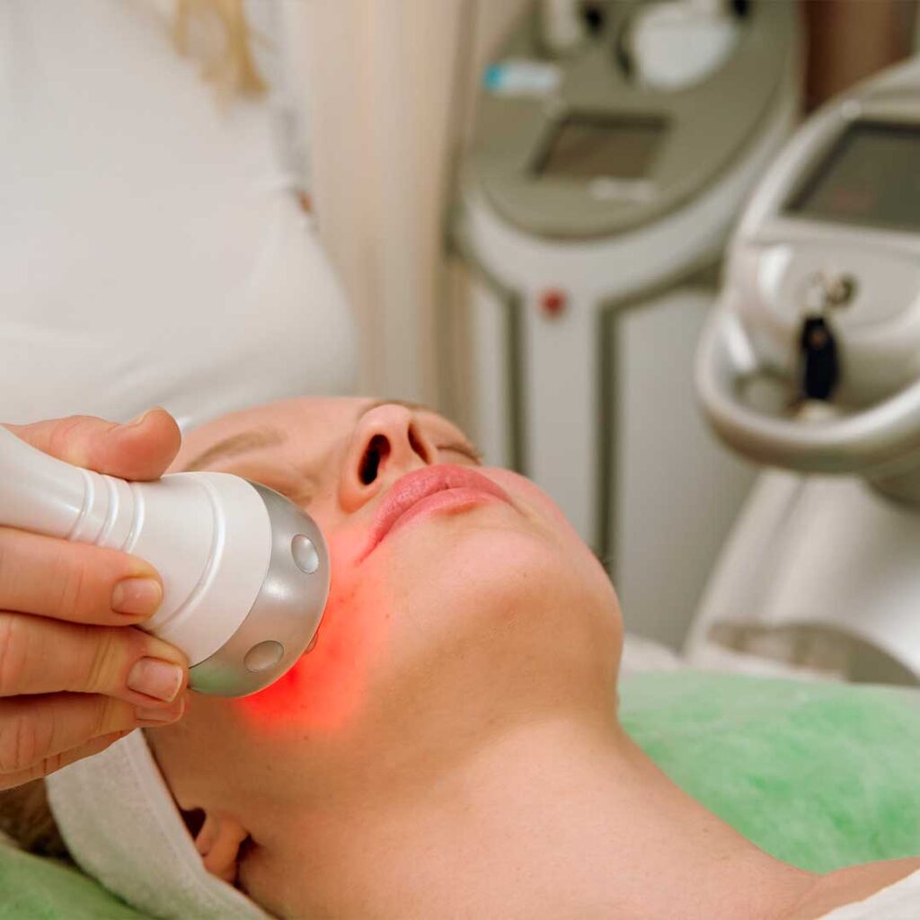 RF-лифтинг лица на аппарате 3-MAX