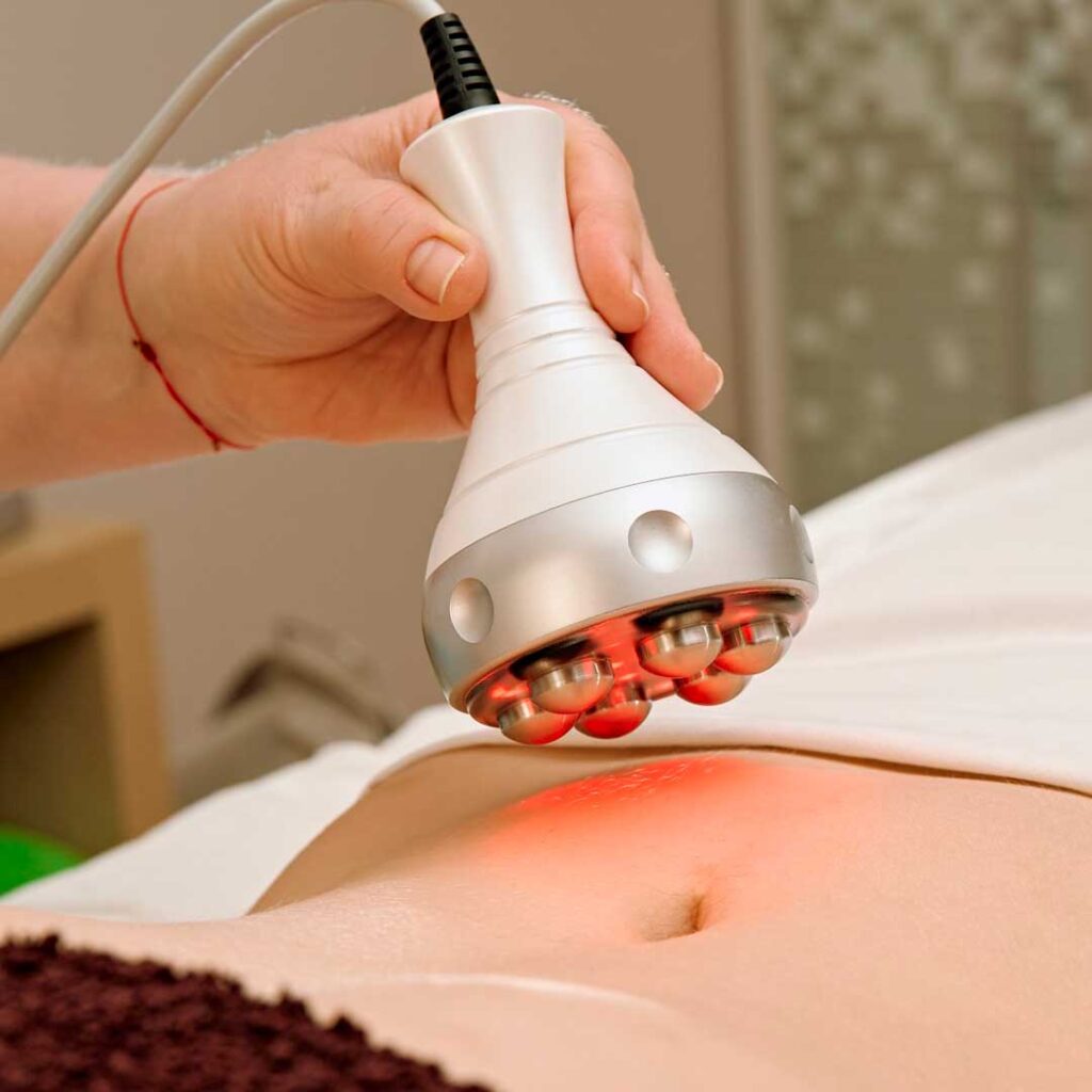 RF-лифтинг тела на аппарате 3-MAX в Екатеринбурге