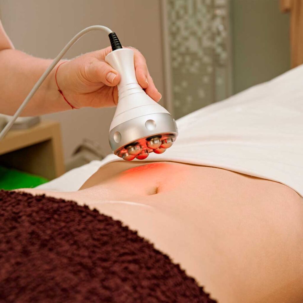 RF-лифтинг тела на аппарате 3-MAX в Екатеринбурге