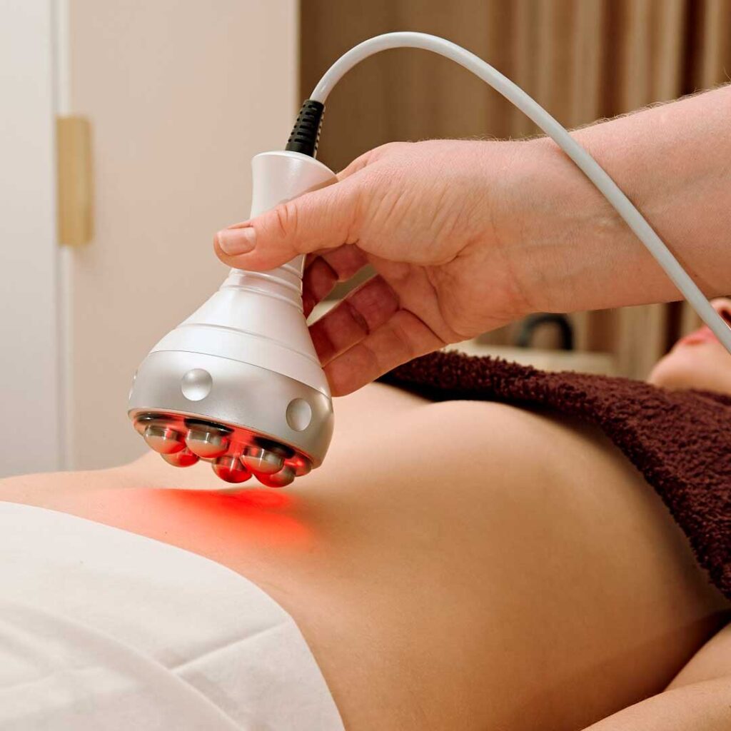 RF-лифтинг тела на аппарате 3-MAX в Екатеринбурге